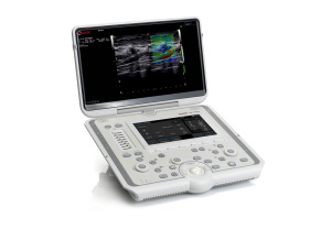 Ультразвуковой MyLab Omega (Esaote, Италия)