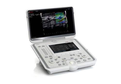 Ультразвуковой MyLab Omega (Esaote, Италия)