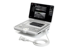 Ультразвуковой аппарат MyLab Sigma (Esaote, Италия)