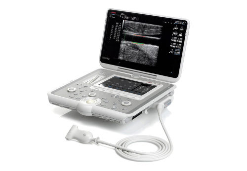 Ультразвуковой аппарат MyLab Sigma (Esaote, Италия)